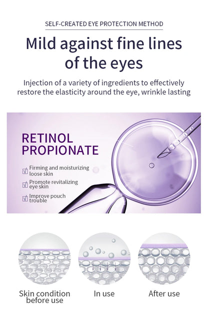 O'CHEAL Rapid Wrinkle Repair Eye Cream: Triple-Roller Massager & Hyaluronic Acid