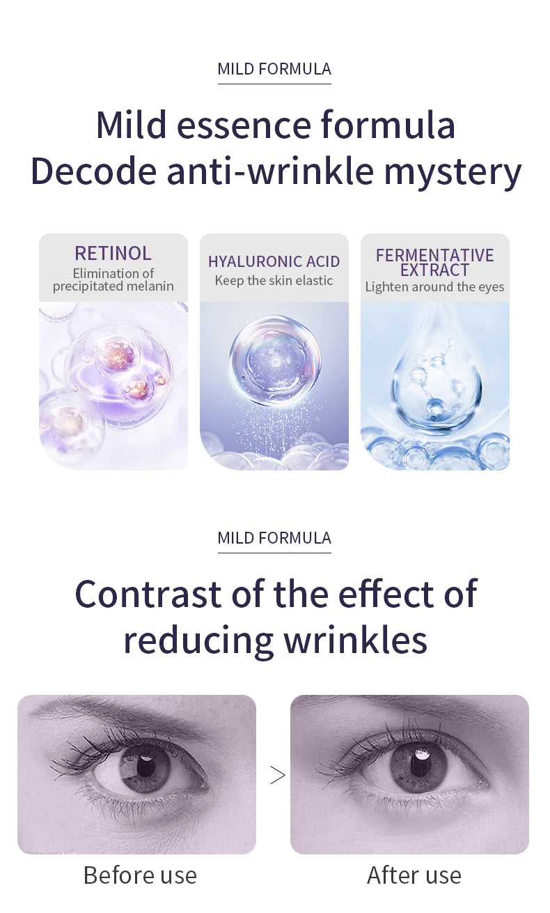 O'CHEAL Rapid Wrinkle Repair Eye Cream: Triple-Roller Massager & Hyaluronic Acid