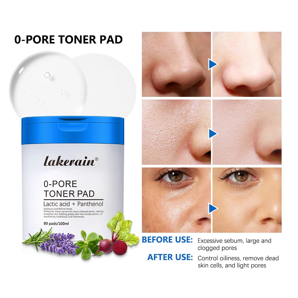 Before and after comparison showing reduced sebum, cleared blackheads, and refined pores after using lakerain toner pads.