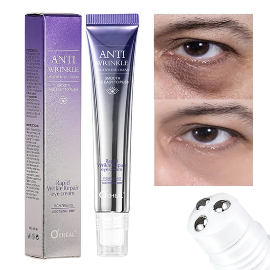 Before and after comparison of O'CHEAL eye cream showing a visible reduction in under-eye wrinkles and fine lines.
